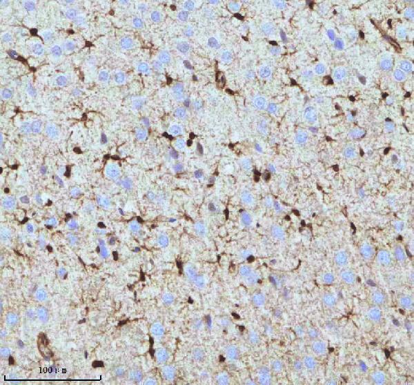 m01874 qki primary antibodies ihc testing 11_1
