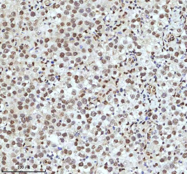 m01874 qki primary antibodies ihc testing 5_1
