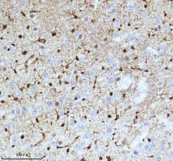 m01874 qki primary antibodies ihc testing 7