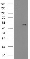 HEK293T cells were transfected with the pCMV6-ENTRY control (Left lane) or pCMV6-ENTRY PDGFD (Right lane) cDNA for 48 hrs and lysed
