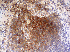 Immunohistochemical staining of paraffin-embedded Human lymph node tissue within the normal limits using anti-OAS2 mouse monoclonal antibody