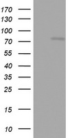 HEK293T cells were transfected with the pCMV6-ENTRY control (Left lane) or pCMV6-ENTRY OAS2 (Right lane) cDNA for 48 hrs and lysed