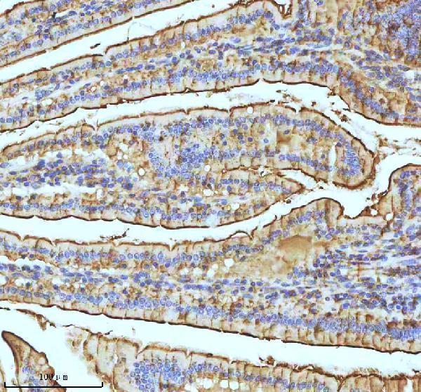  IHC analysis of Xanthine Oxidase using anti-Xanthine Oxidase antibody (M01884-2)
