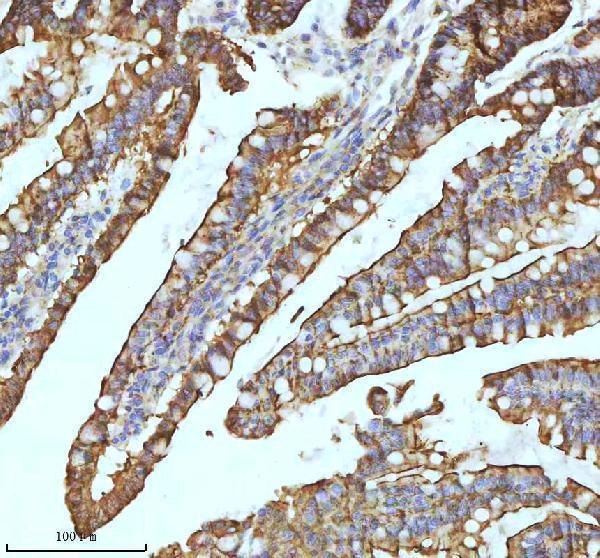 m01884 2 xdh primary antibodies ihc testing 5