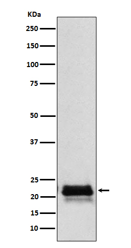 Western blot analysis of FSH beta (FSHB) expression in Human pituitary lysate