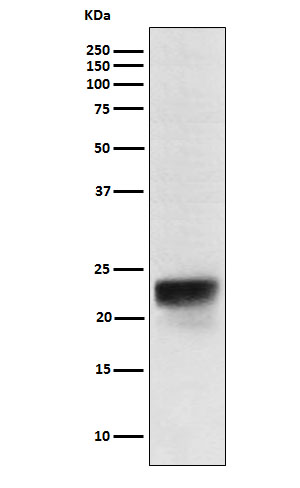 Western blot analysis of FSH beta expression in Human pituitary lysate