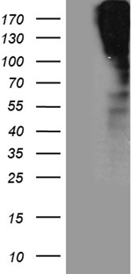 HEK293T cells were transfected with the pCMV6-ENTRY control (Left lane) or pCMV6-ENTRY SORL1 (Right lane) cDNA for 48 hrs and lysed