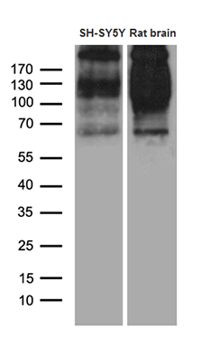 Western blot analysis of extracts (35ug) from SH-SY5Y cell line and rat brain tissue lysate by using anti-SORL1 monoclonal antibody (1:500)