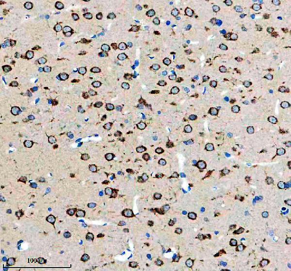 m01887 1 sorl1 primary antibodies ihc testing 3