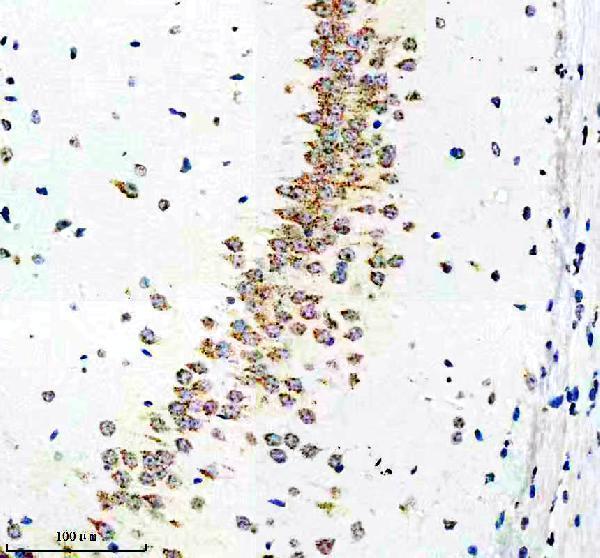 IHC analysis of SORLA using anti-SORLA antibody (M01887-2)