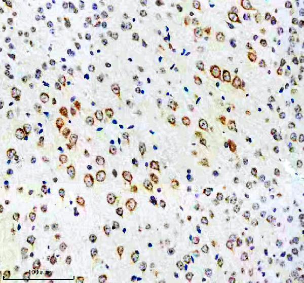 IHC analysis of SORLA using anti-SORLA antibody (M01887-2)