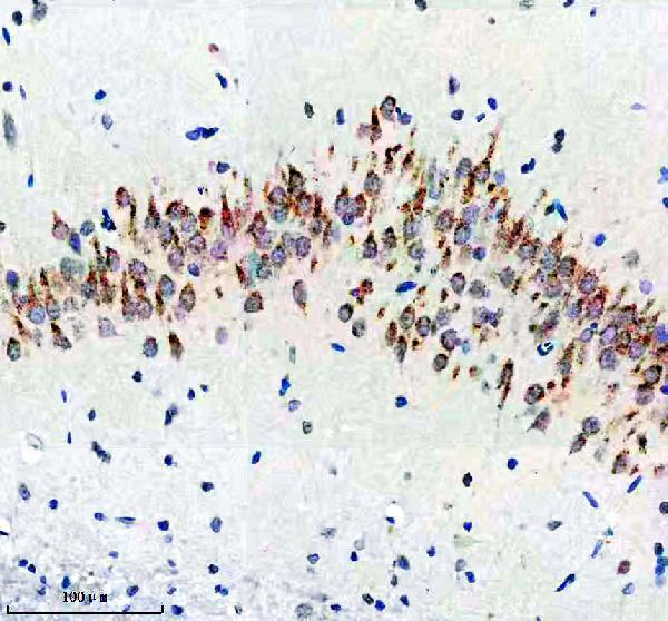m01887 2 sorla primary antibodies ihc testing 3