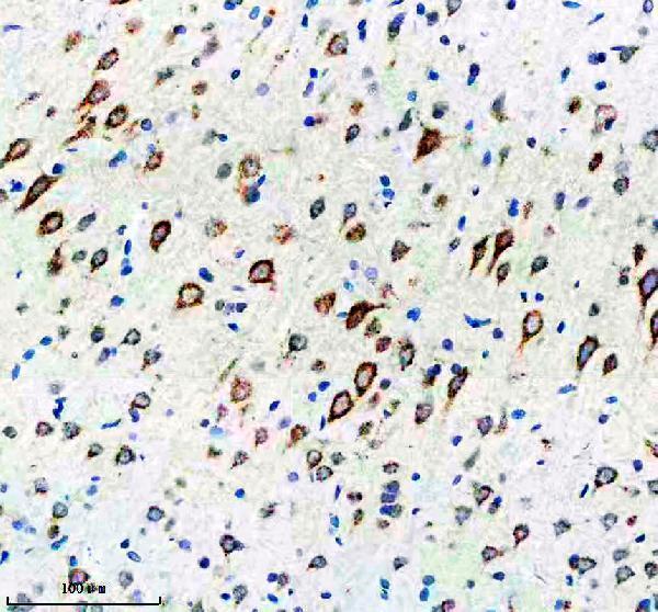 m01887 2 sorla primary antibodies ihc testing 4