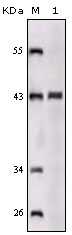 Western blotting validation for Anti-SorLA SORL1 Monoclonal Antibody M01887
Western Blot (WB) analysis using SorLA Monoclonal Antibody against truncated SorLA recombinant protein