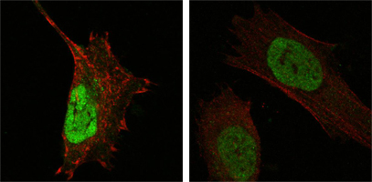 m01889 mdm4 primary antibodyes if testing 3