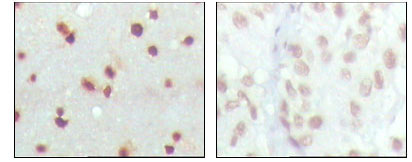 m01889 mdm4 primary antibodyes ihc testing 2