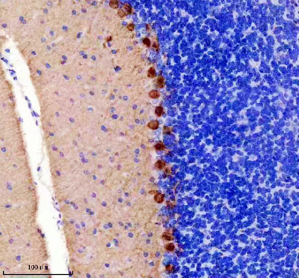 IHC analysis of PKC gamma using anti-PKC gamma antibody (M01890-2)