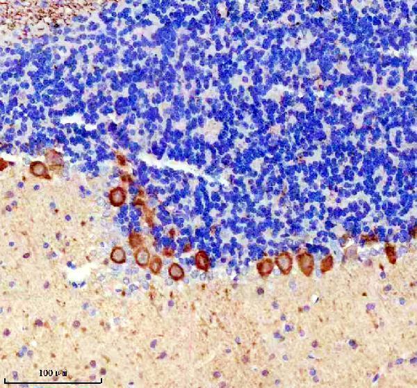 IHC analysis of PKC gamma using anti-PKC gamma antibody (M01890-2)