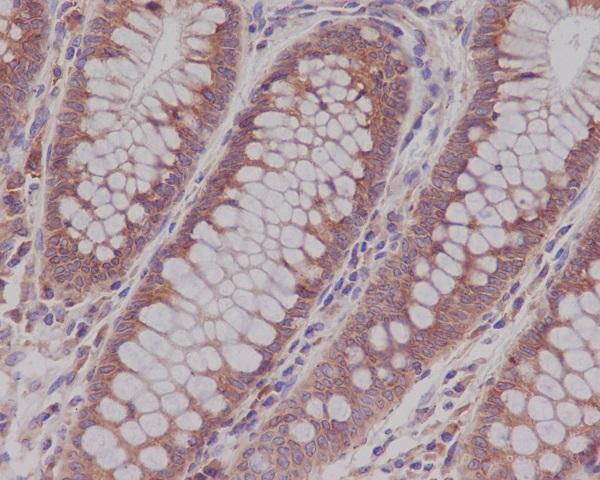 Immunohistochemical analysis of paraffin-embedded human colon, using Rab5 Antibody