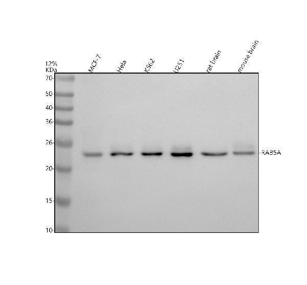 Western blot analysis of RAB5A using anti-RAB5A antibody (M01891)