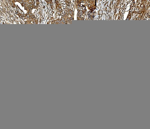 m01893 1 pp2a1 primary antibodies ihc testing 4