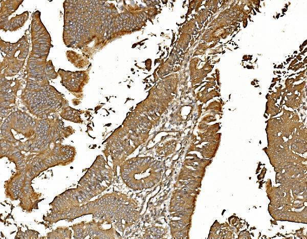 m01893 1 pp2a1 primary antibodies ihc testing 5