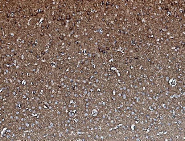 m01893 1 pp2a1 primary antibodies ihc testing 6