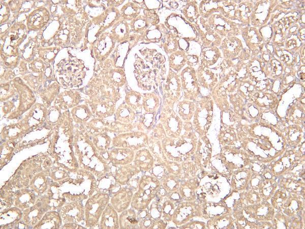 m01893 2 ppp2ca primary antibodies ihc testing 2