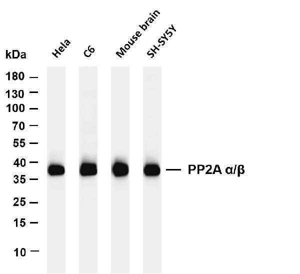 m01893 2 ppp2ca primary antibodies wb testing 1