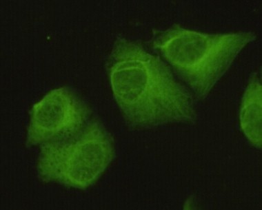 m01893 ppp2ca primary antibodyes if testing 2