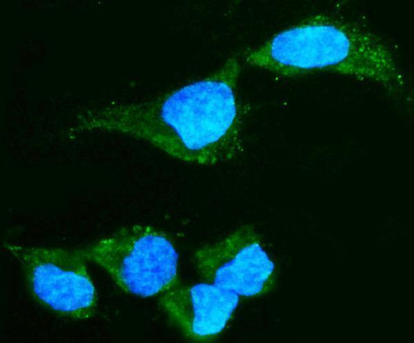 IF analysis of Alpha A Crystallin using anti-Alpha A Crystallin antibody (M01900-2)
