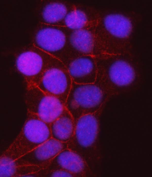 m01901 3 gamma catenin primary antibodies if testing 4