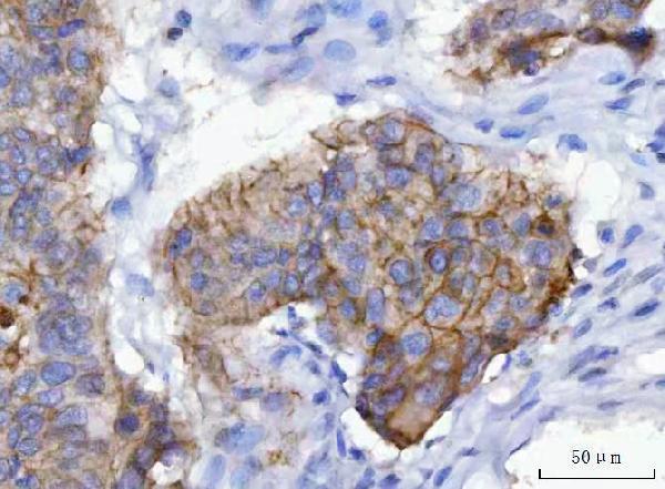  IHC analysis of gamma Catenin using anti-gamma Catenin antibody (M01901-3)