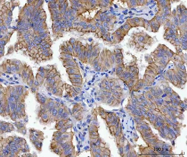  IHC analysis of gamma Catenin using anti-gamma Catenin antibody (M01901-3)