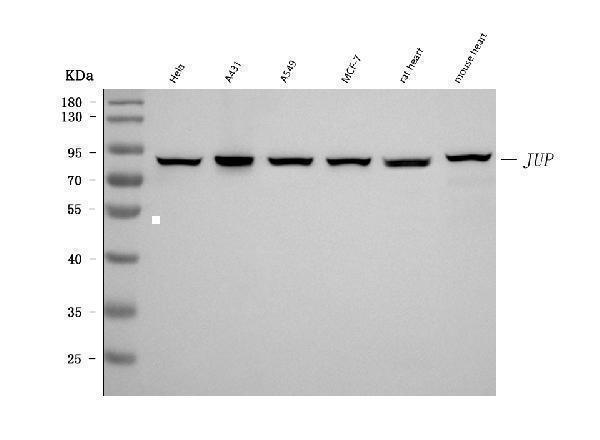  Western blot analysis of gamma Catenin using anti-gamma Catenin antibody (M01901-3)