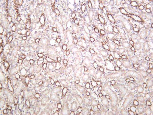 m01906 2 pdha1 primary antibodies ihc testing 1