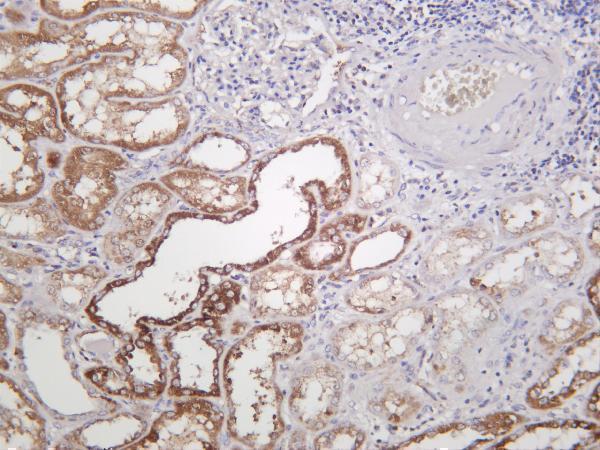 m01906 2 pdha1 primary antibodies ihc testing 2