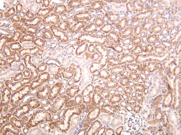 m01906 2 pdha1 primary antibodies ihc testing 3
