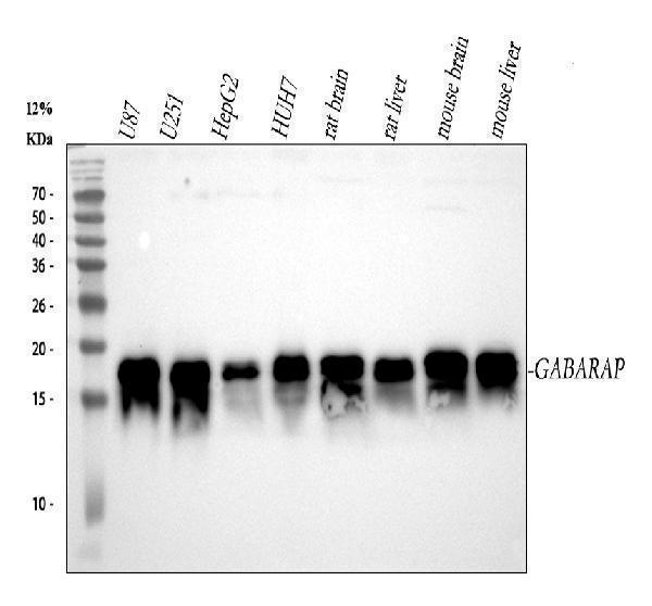  Western blot analysis of GABARAP using anti-GABARAP antibody (M01907)