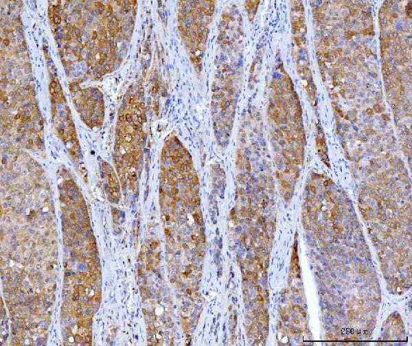  IHC analysis of HGD using anti-HGD antibody (M01909-1)