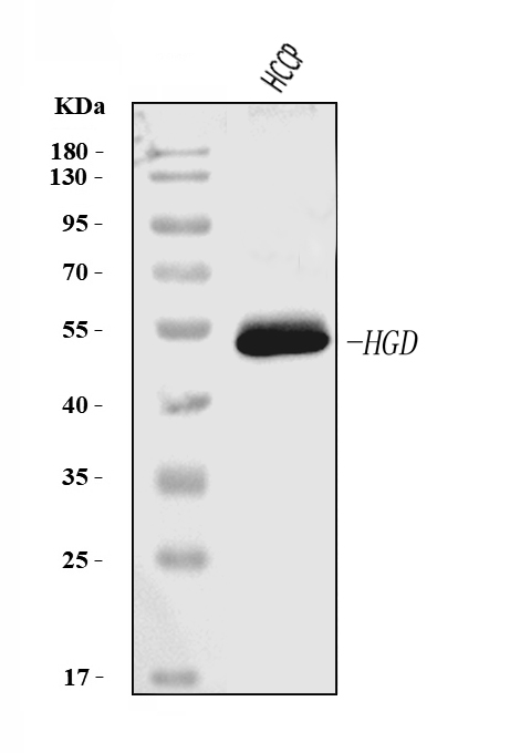  Western blot analysis of HGD using anti-HGD antibody (M01909-1)