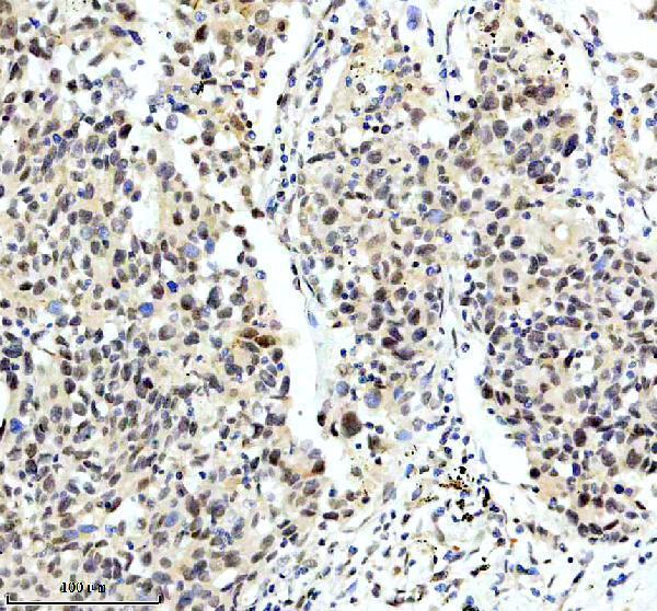 m01910 wdr5 primary antibodies ihc testing 1