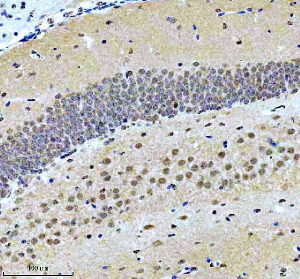 m01910 wdr5 primary antibodies ihc testing 2