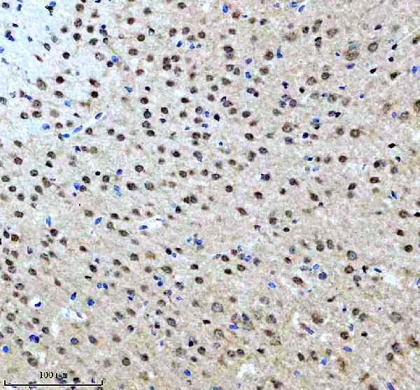 m01910 wdr5 primary antibodies ihc testing 3