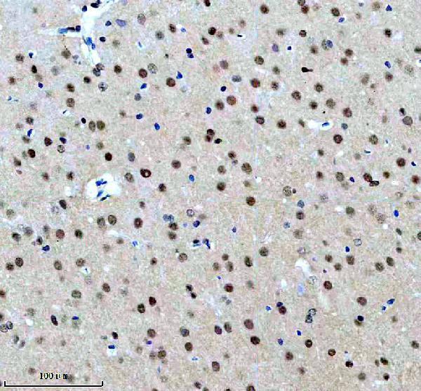 m01910 wdr5 primary antibodies ihc testing 4