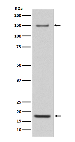 Western blot analysis of Integrin alpha 5 expression in Mouse heart lysate