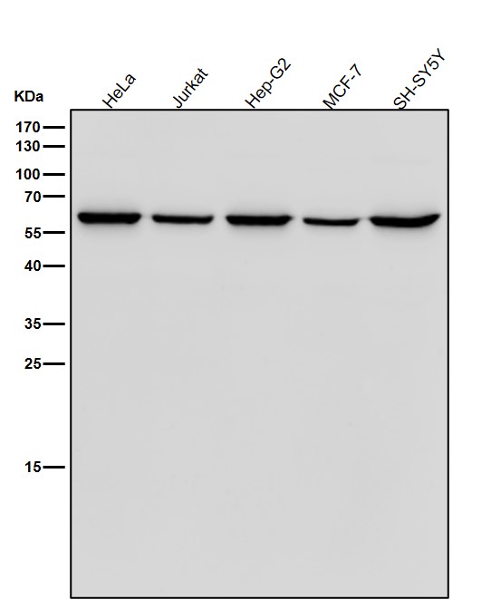 All lanes use the Antibody at 1:5K dilution for 1 hour at room temperature. All lanes use the Antibody at 1:5K dilution for 1 hour at room temperature.