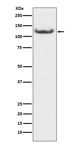 Western blot analysis of HDAC7 expression in HeLa cell lysate