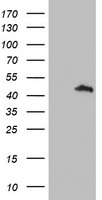 HEK293T cells were transfected with the pCMV6-ENTRY control (Left lane) or pCMV6-ENTRY SERPINA5 (Right lane) cDNA for 48 hrs and lysed