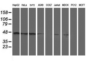 Western blot analysis of extracts (35ug) from 9 different cell lines by using anti-SERPINA5 monoclonal antibody
